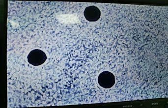 精密微孔加工認(rèn)準(zhǔn)鑫濤源：0.05mm孔精度超穩(wěn)